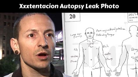 xxx autopsy leak|I’m so glad no one leaked Xs autopsy pictures :。